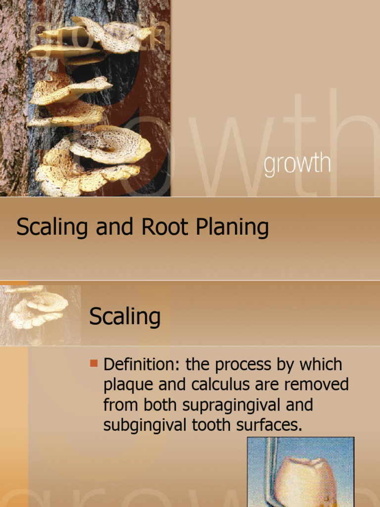 Scaling and Root Planing Overview | PDF | Human Tooth | Dental Anatomy