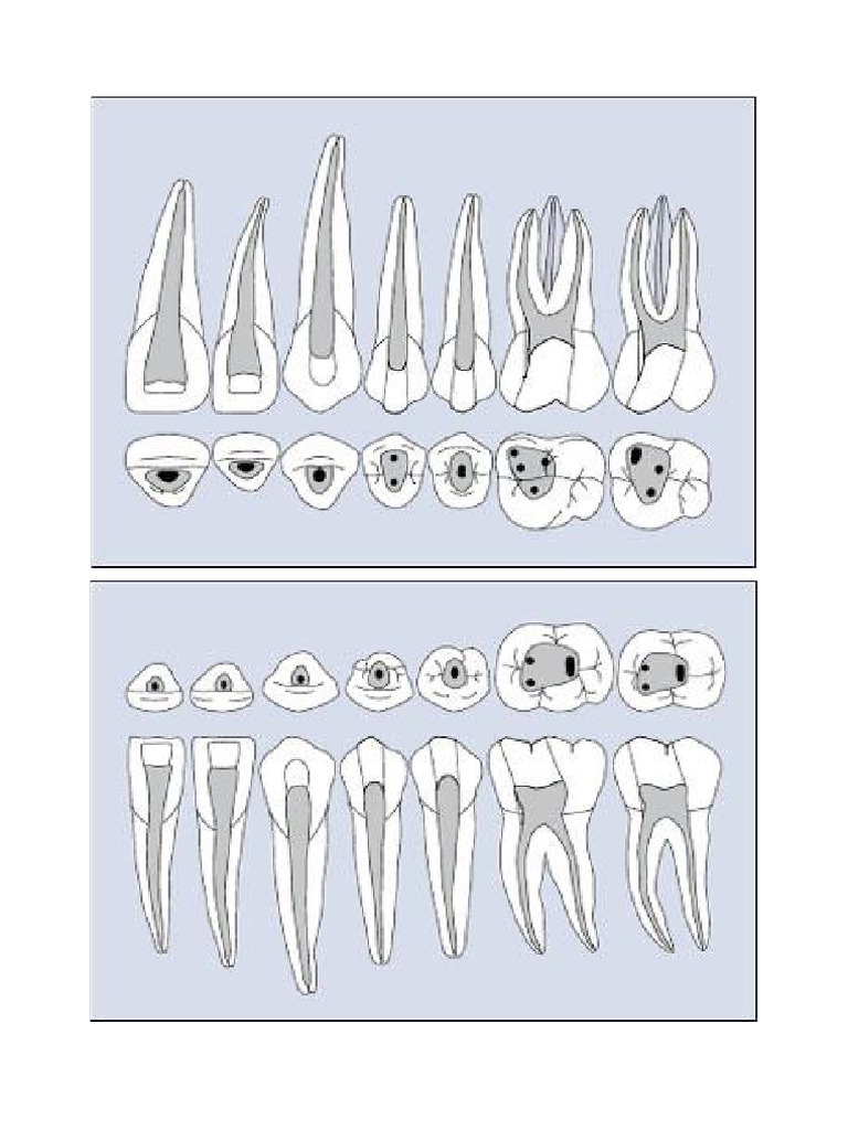 Endodontic Access Cavity | PDF