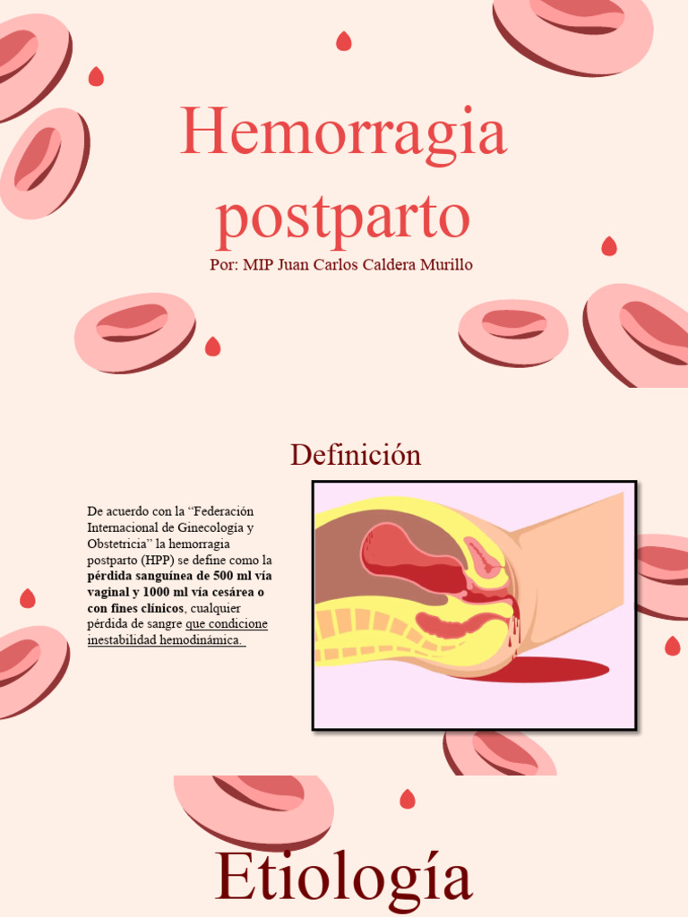 Hemorragia Postparto | PDF | Parto | Embarazo humano