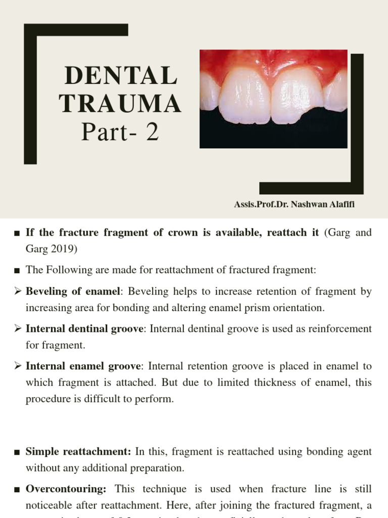 Dental Trauma 2 5th Year | PDF | Human Tooth | Dental Anatomy