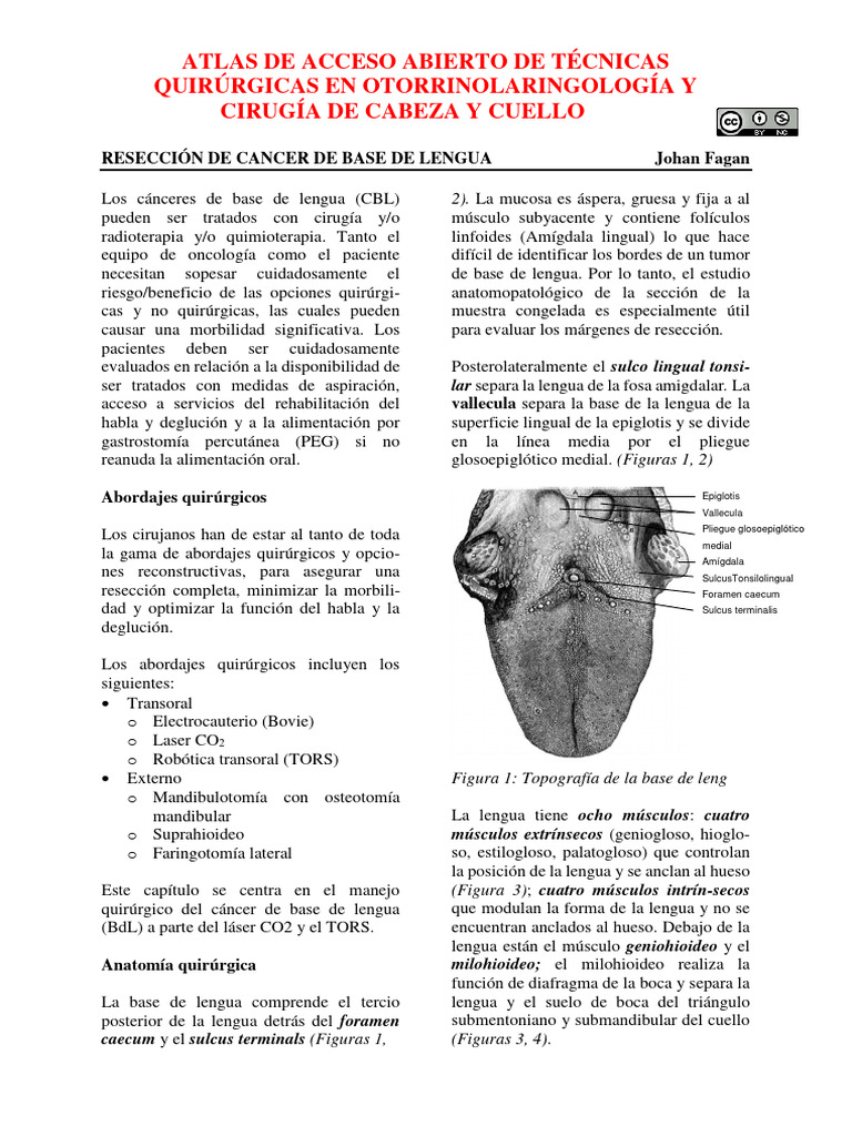 resecci-n-de-cancer-de-base-de-lengua-pdf-lengua-cabeza-y-cuello