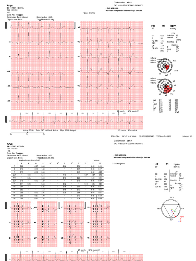 EcgReport 2024 07 27 09 39 04 | PDF | Electrocardiography | Heart