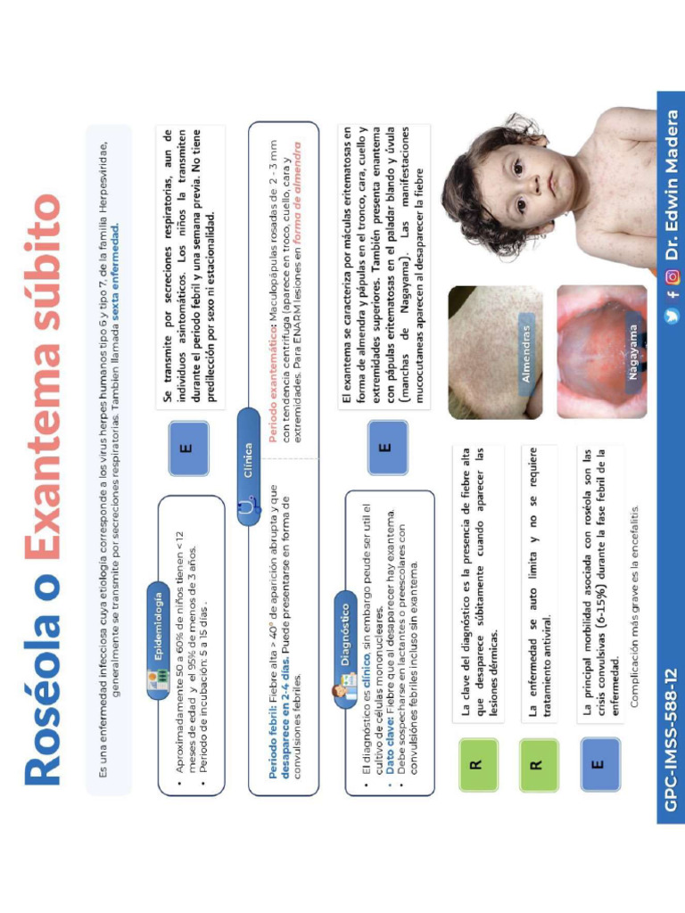 Roseonla O Exantema Subito Pdf