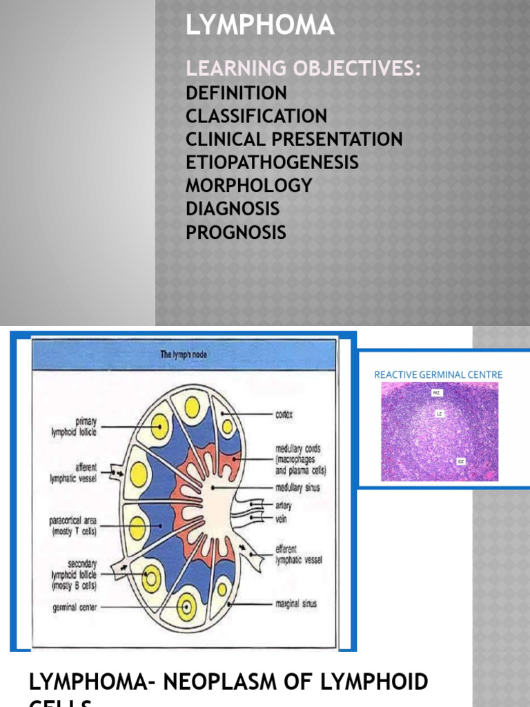 Comprehensive Guide to Lymphoma Types | PDF | Lymphoma | Lymphocyte