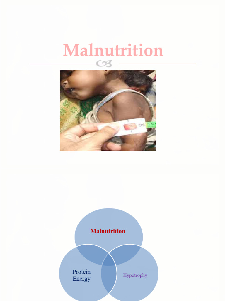 Understanding Malnutrition and PEM | PDF | Malnutrition | Determinants ...