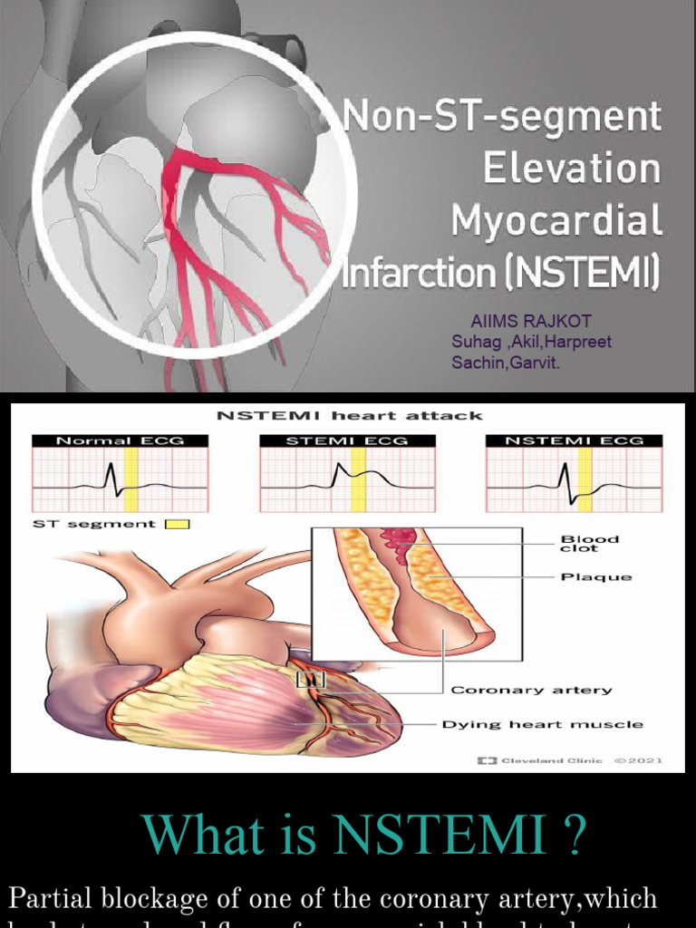 NSTEMI | PDF
