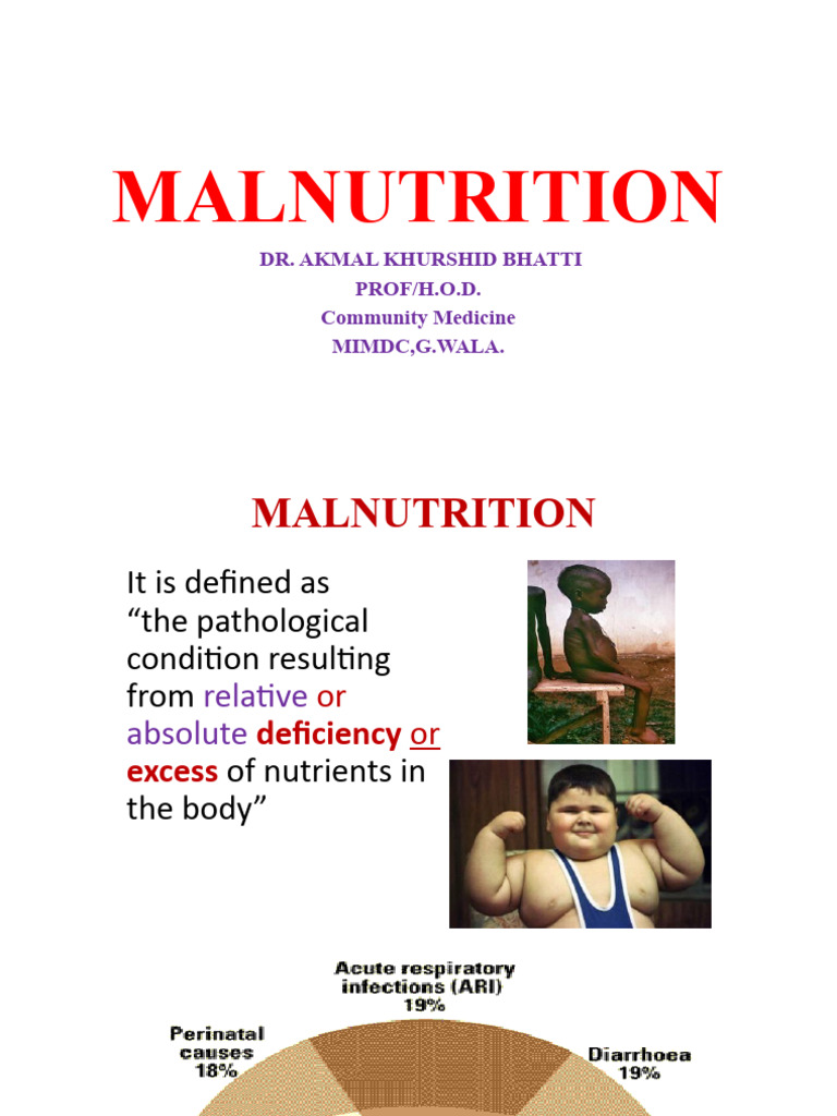 NT 3 Malnutrition AKB | PDF | Malnutrition | Nutrition