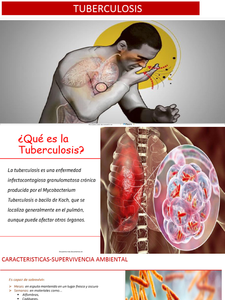 Guía Completa sobre Tuberculosis | PDF | Tuberculosis | Ciencias de la ...