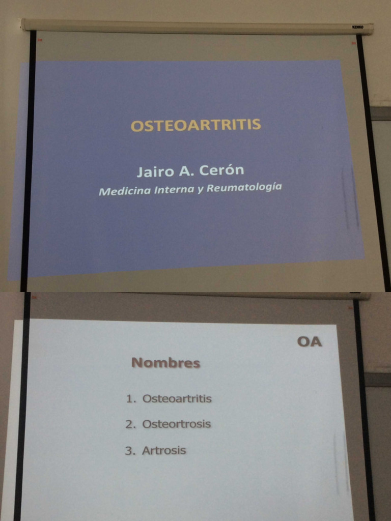 Osteo Art Ritis | PDF