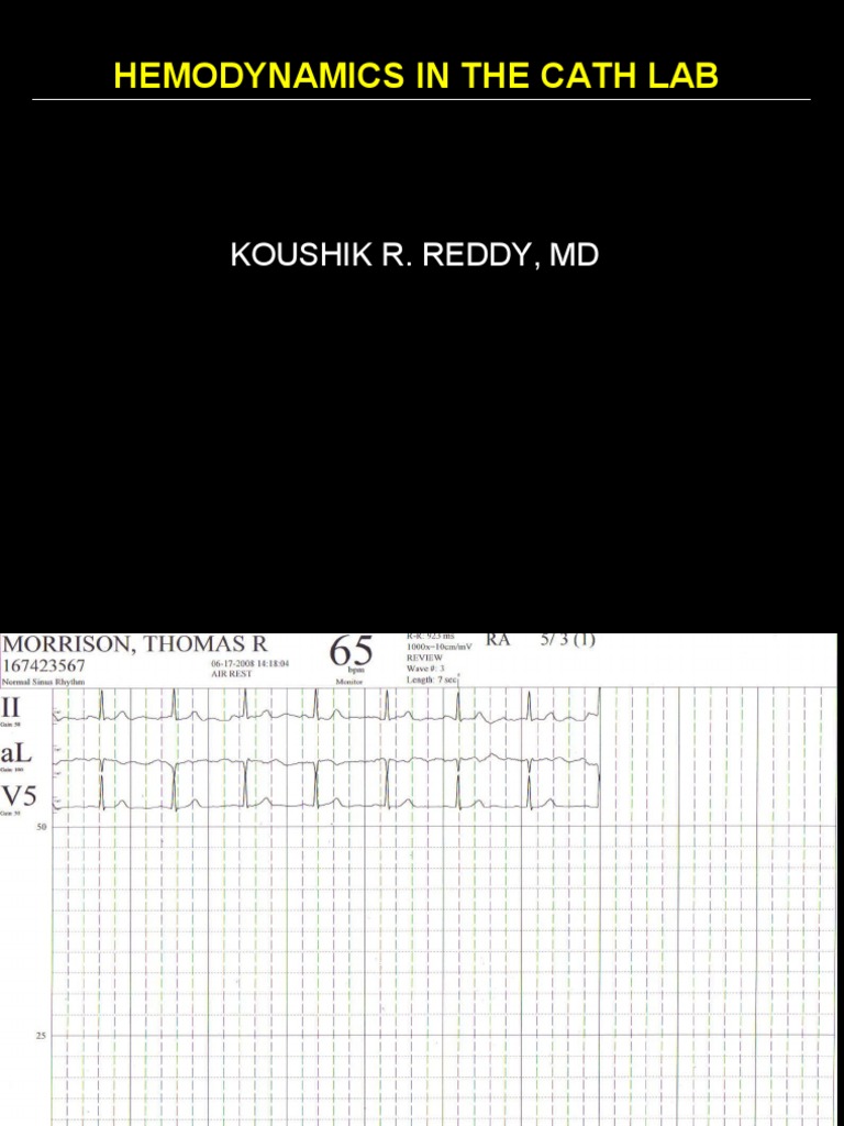 Hemodynamics in The Cath Lab 2 PDF Amplitude Frequency