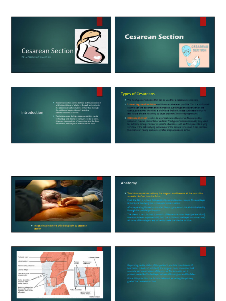 Lec-04 Cesarean Section Management and ED | PDF | Caesarean Section ...
