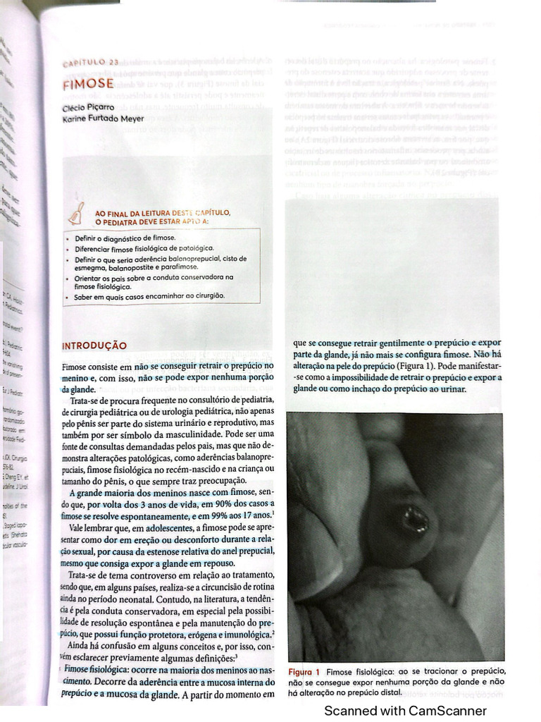 Fimose Tratado | PDF