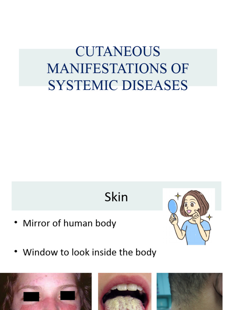 Systemic Diseases 1.1 | PDF | Clinical Medicine | Causes Of Death