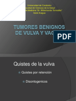 Tumores Benignos de Vulva y Vagina