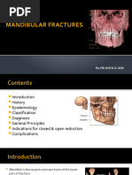 Synthes MatrixMANDIBLe | PDF | Screw | Stress (Mechanics)