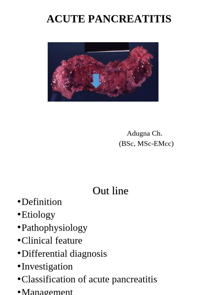 Acute Pancreatitis Overview and Management | PDF | Pancreas | Medical ...