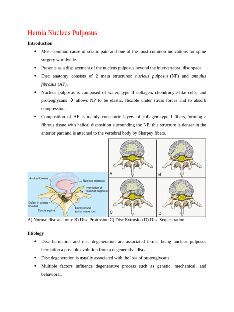 Hernia nucleus pulposus pdf vertebral column back pain