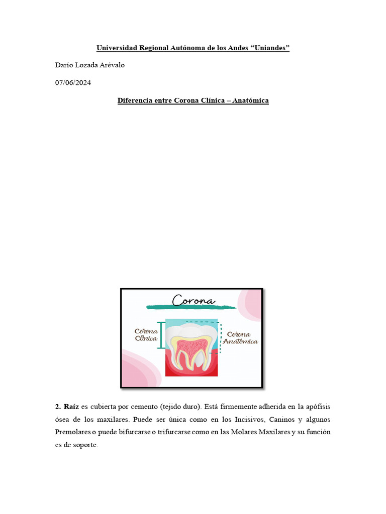 Diferencia entre Corona Clínica y Anatómica - Síndrome combinado de ...