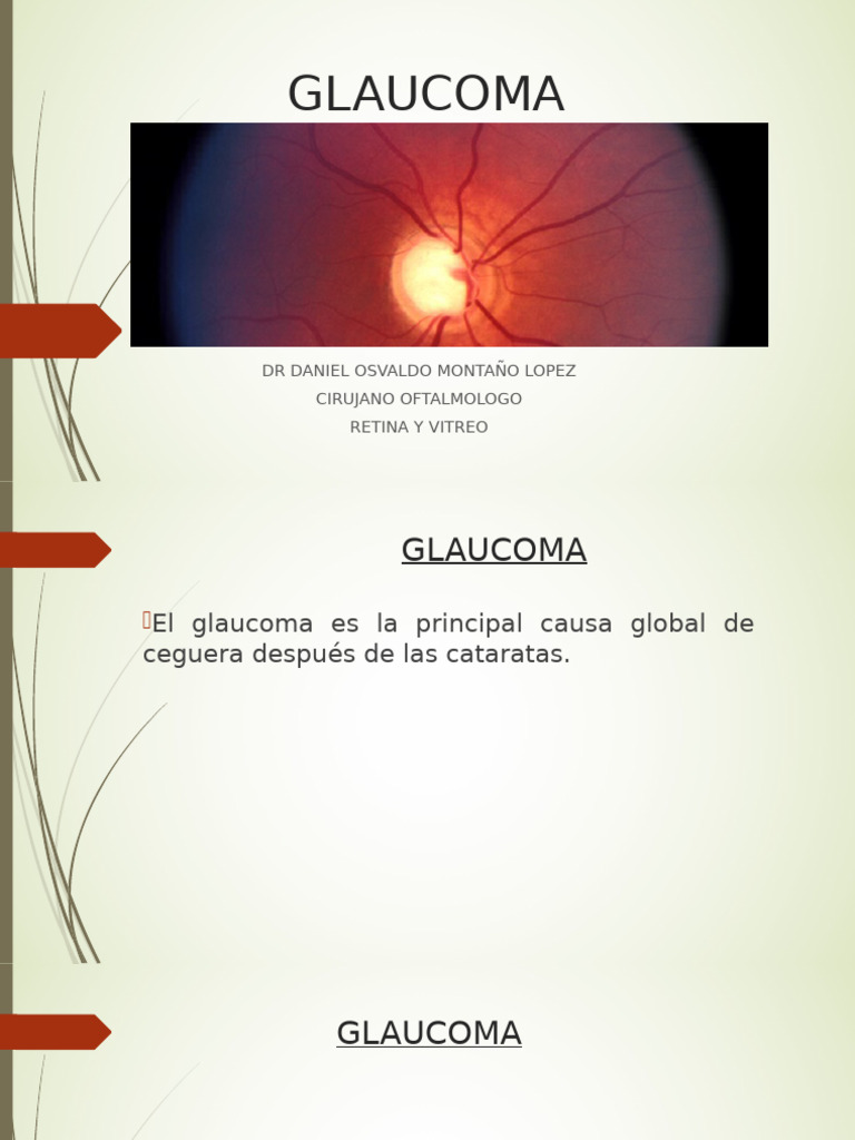 Glaucoma | PDF | Glaucoma | Ciencia y matemáticas