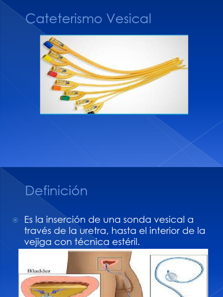 Sonda Vesical Power | PDF