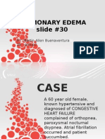 Pulmonary Edema