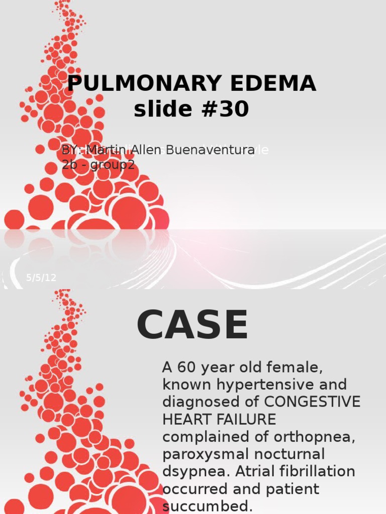Pulmonary Edema | PDF | Edema | Heart Failure