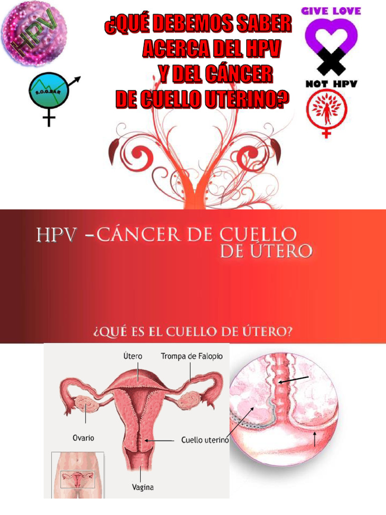 Que Hay Que Saber Del HPV y El Cancer de Cuello Uterino | PDF