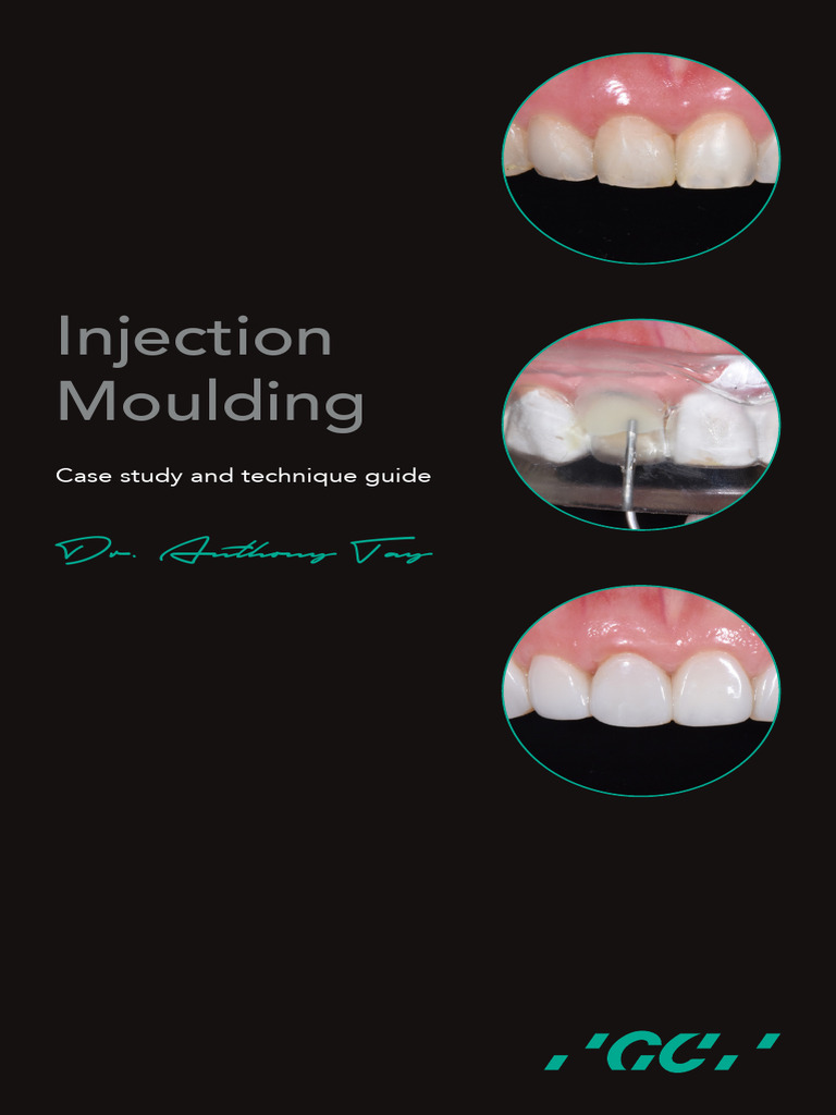 injection-moulding-technique-guide | PDF