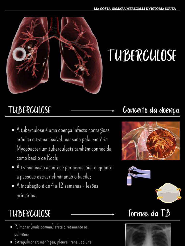 Tuberculose: Sintomas, Diagnóstico e Tratamento | PDF | Tuberculose ...
