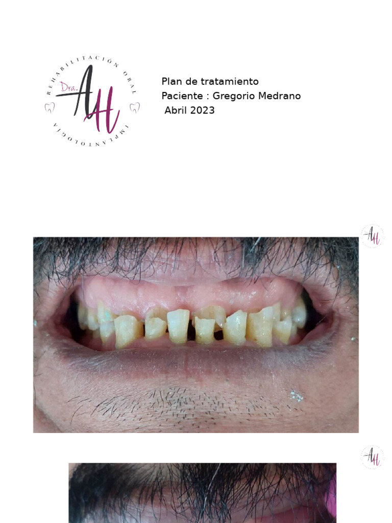 Egorio Medrano | PDF