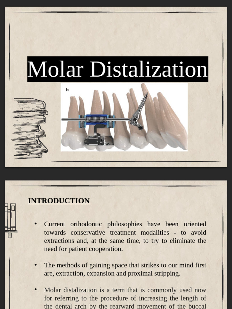 Seminar Presentation Distalisation of Molars Prithvi 1 | PDF