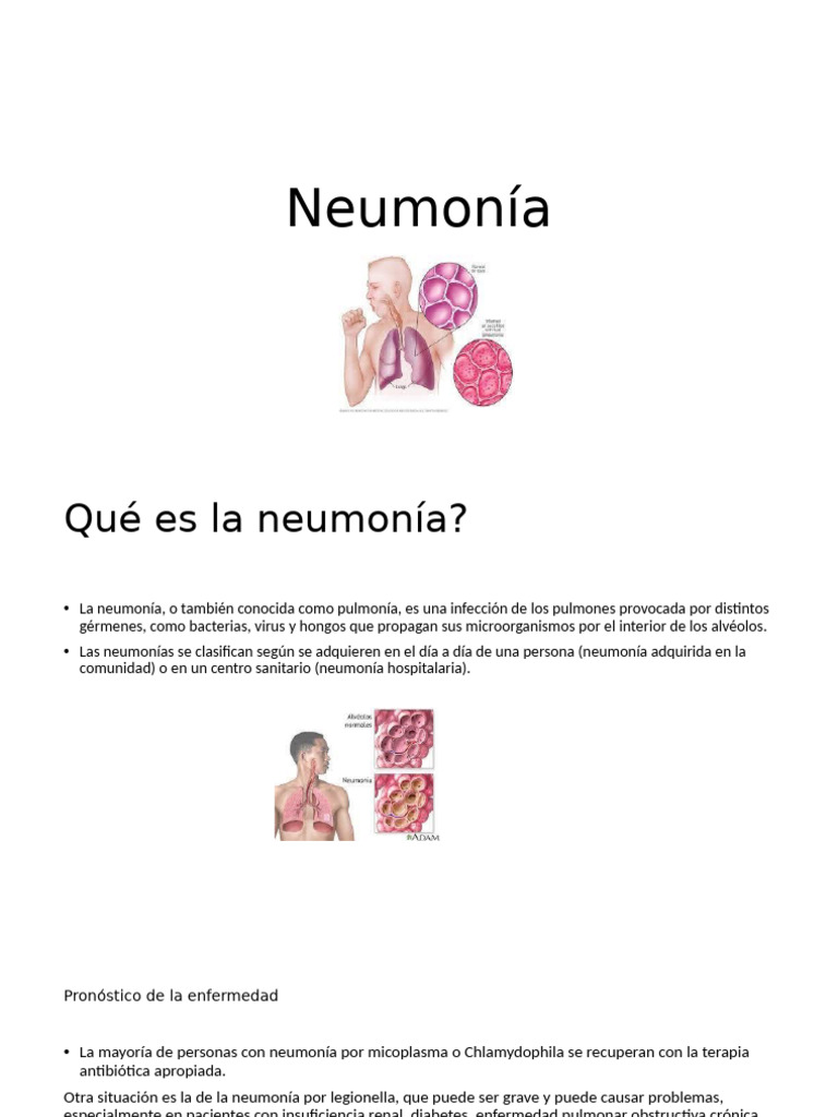 Neumonia | PDF