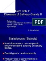 Slide 15 Diseases of Salivary Glands II