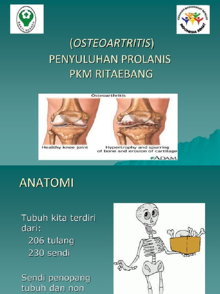 Osteoarthritis Pdf