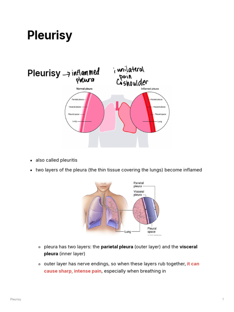 Pleurisy | PDF