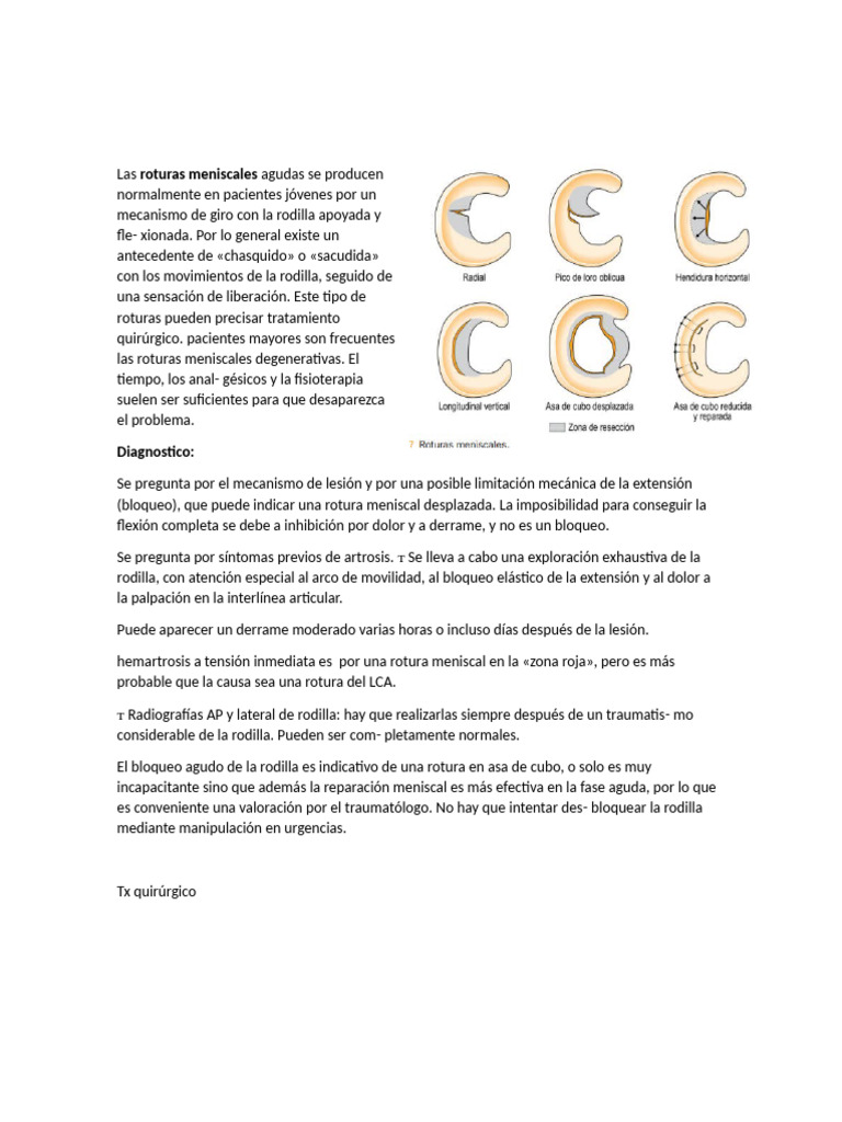 Ruptura de Ligamentos | PDF