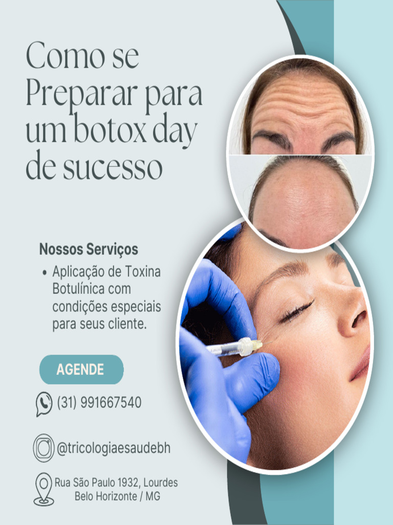 Guia para um Botox Day de Sucesso | PDF | Toxina botulínica | Carreira ...