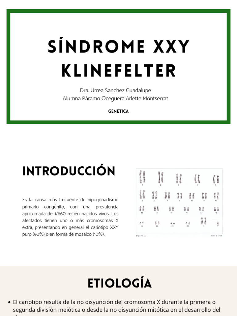 Sindrome Klinefelter | PDF