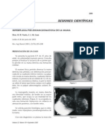 Hiperplasia Pseudoangiomatosa de La Mama - Presentación de Caso Vuoto MC Lean SAMAS 2004