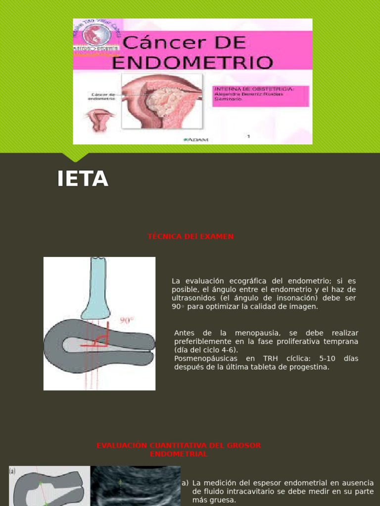 IETA | PDF