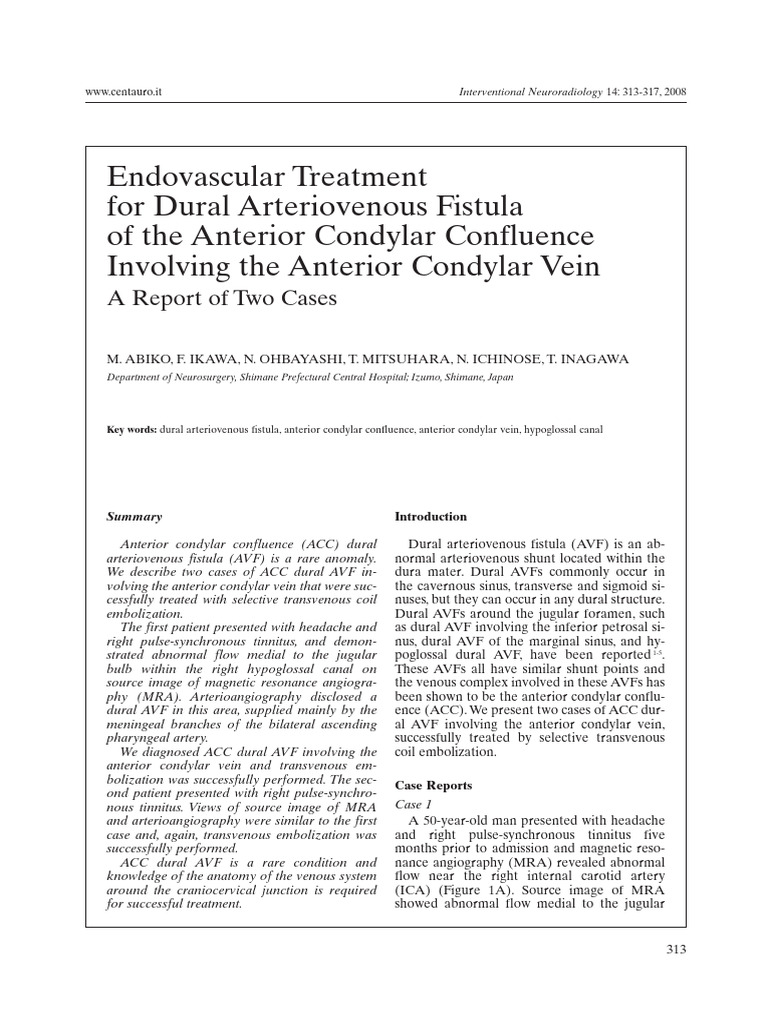 Endovascular Treatment For Dural Arteriovenous Fis | PDF