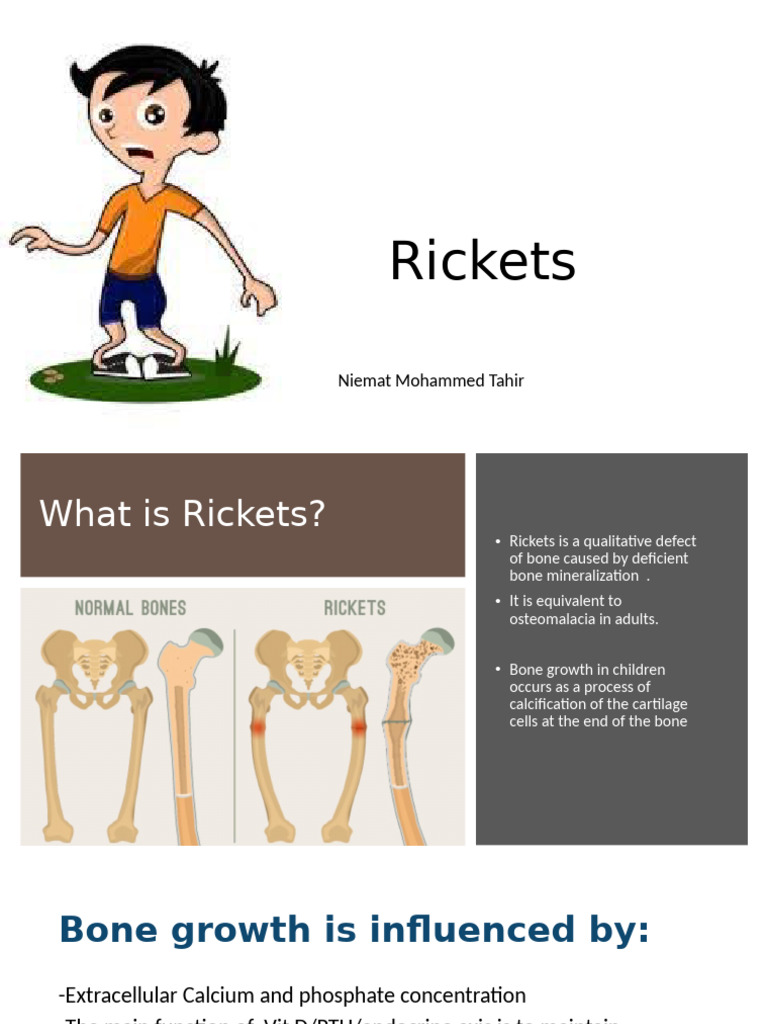 Rickets | PDF