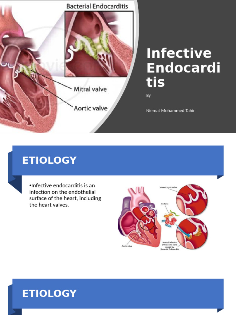 Infective Endocarditis | PDF