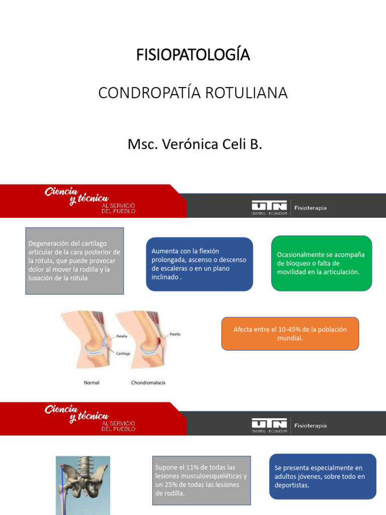 Condropatía Rotuliana | PDF