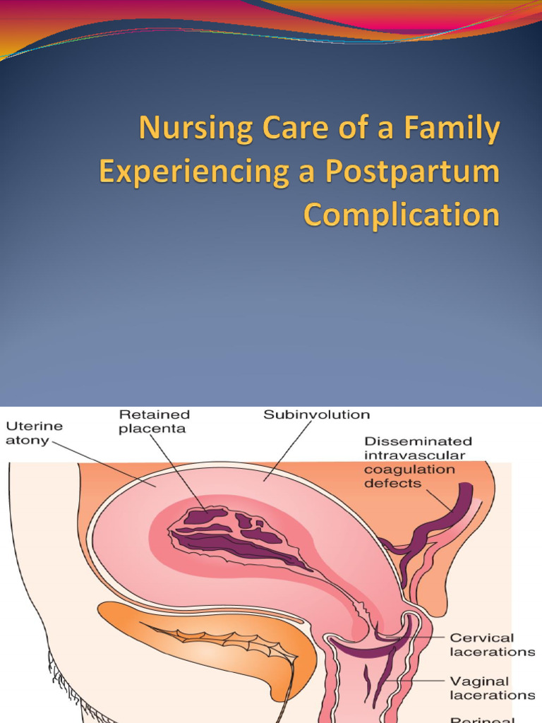 5 Nursing Care of The Postpartum Client 1 | PDF