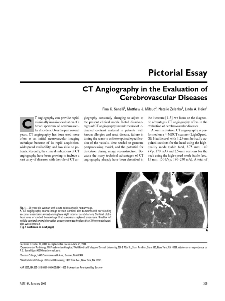 Sanelli Et Al 2012 CT Angiography in The Evaluation of Cerebrovascular ...