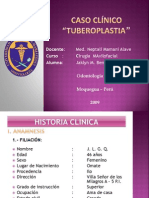 Caso Clínico JLGQ Cirugia Maxilofacial