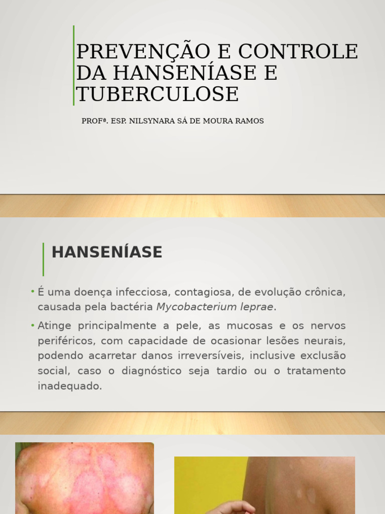 2 Aula Prevenção e Controle Da Hanseníase e Tuberculose | PDF