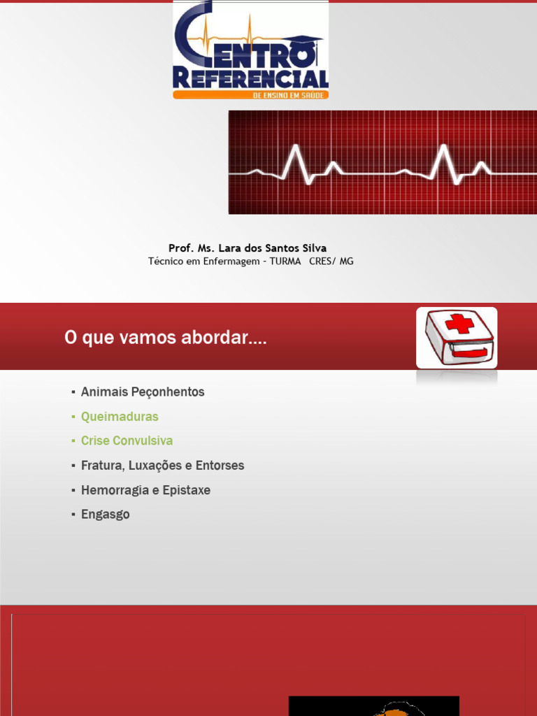 Aula 33 - PS Queimadura e Crise Convuls. | PDF