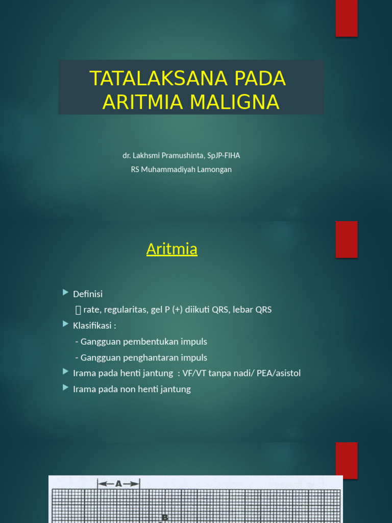 Aritmia RSML 010421 | PDF